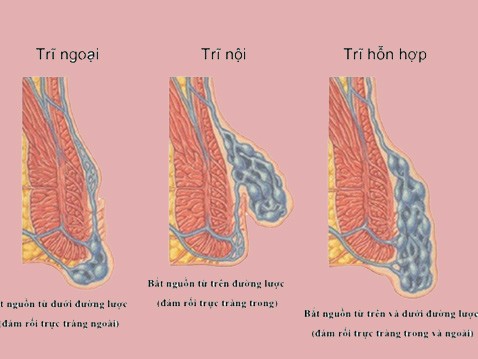 Thuốc Prepation H Ointment