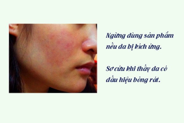 Da bị kích ứng.