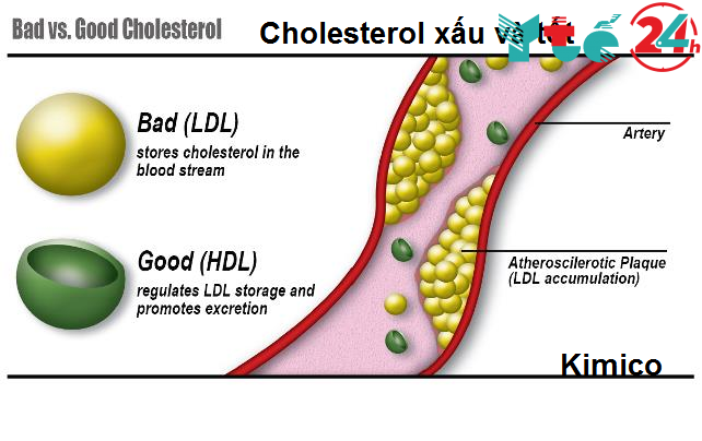 Chỉ số HDL trong máu cao hay thấp là tốt?