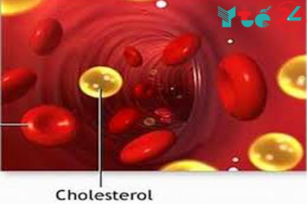 Cholesterol cao là gì?