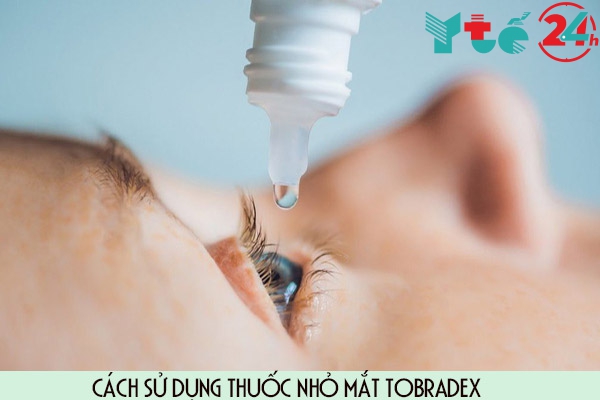 Cách sử dụng thuốc nhỏ mắt Tobradex