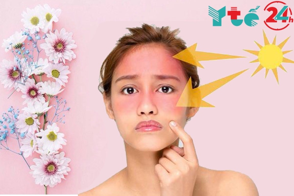 Bôi kem chống nắng lúc nào là thích hợp?