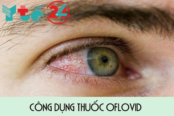 Thuốc Oflovid chữa đau mắt đỏ