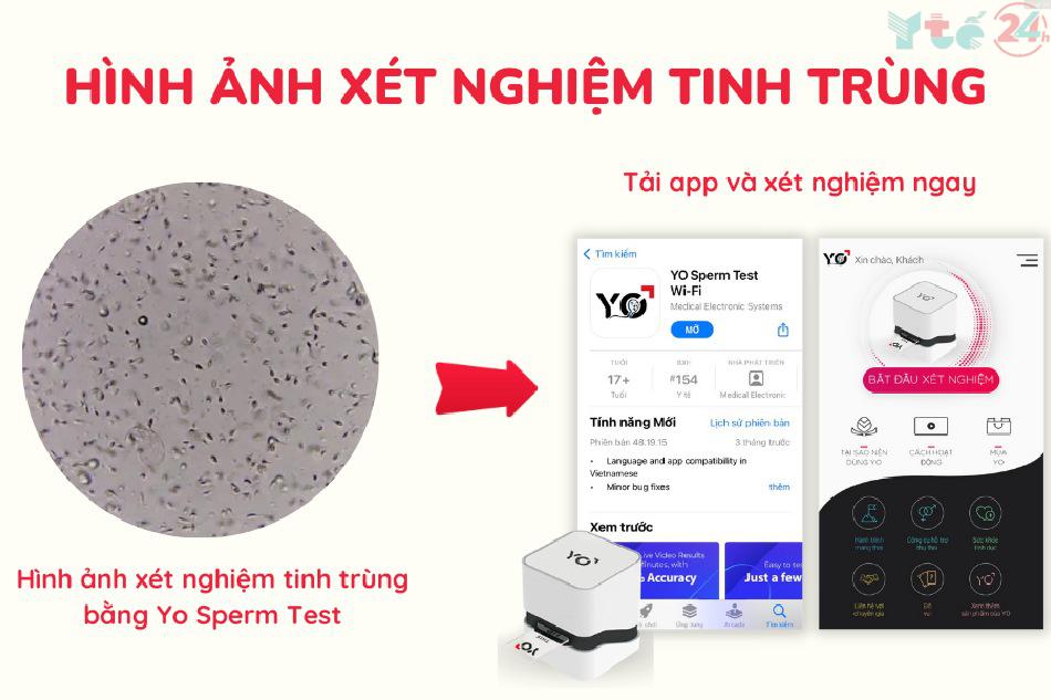 Hình ảnh xét nghiệm tinh trùng từ ứng dụng Yo Sperm Test Wifi 2.0
