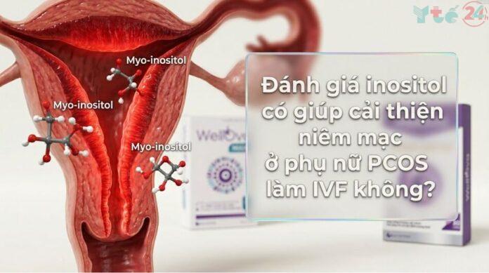 Đánh giá inositol có giúp cải thiện niêm mạc ở phụ nữ PCOS làm IVF không?